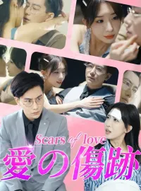 愛の傷跡
